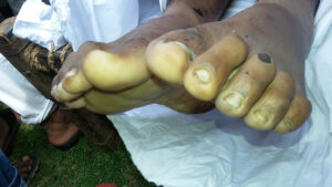 police brutality custodial death jharkhand minhaj ansari